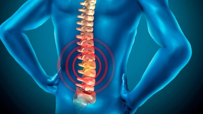 Quiromasaje y espondilitis anquilosante: lo que hay que saber