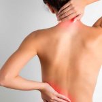 Mujer con inflamación muscular