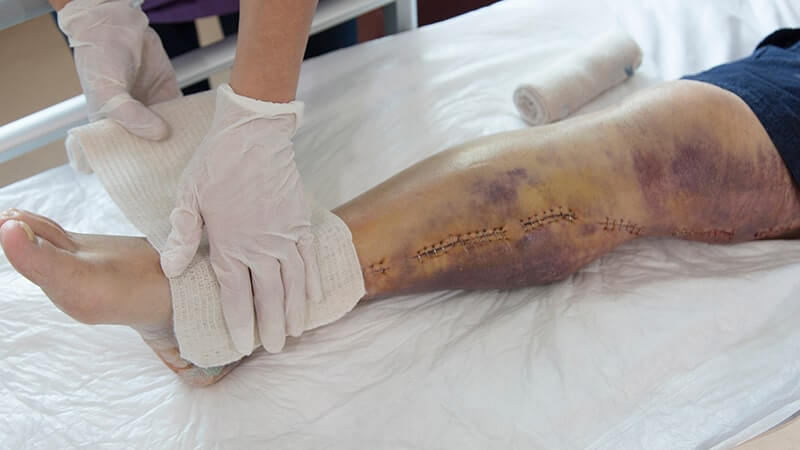 El papel del quiromasaje en la recuperación postoperatoria