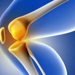 Condromalacia rotuliana: síntomas, causas y protocolo de recuperación