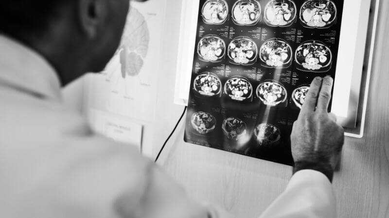 Beneficios del masaje para las personas con enfermedades neurológicas